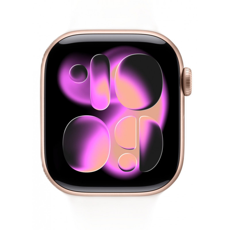 Apple Watch S11 46mm Rose Gold/ Aluminum Case